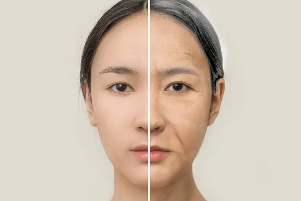 rennova elleva antes e depois