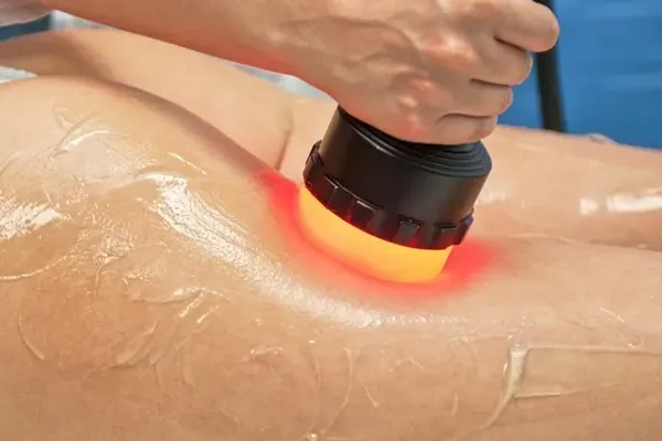 radiofrequencia no tratamento do lipedema