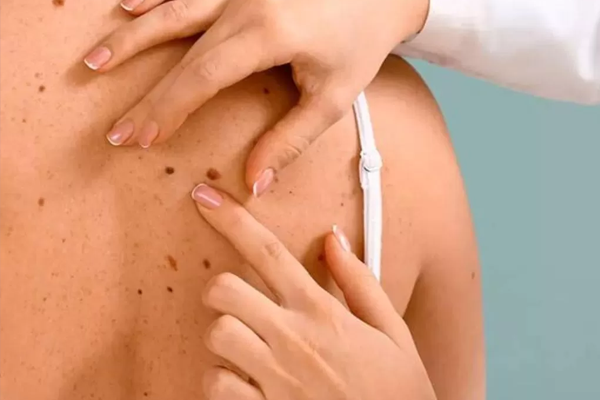 cirurgia de pele em BH