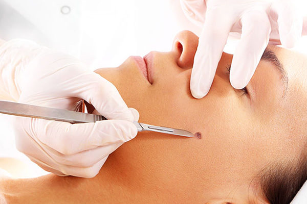 cirurgia dermatologica com segurança