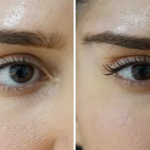 lifting de sobrancelhas ou fox eyes em Belo Horizonte