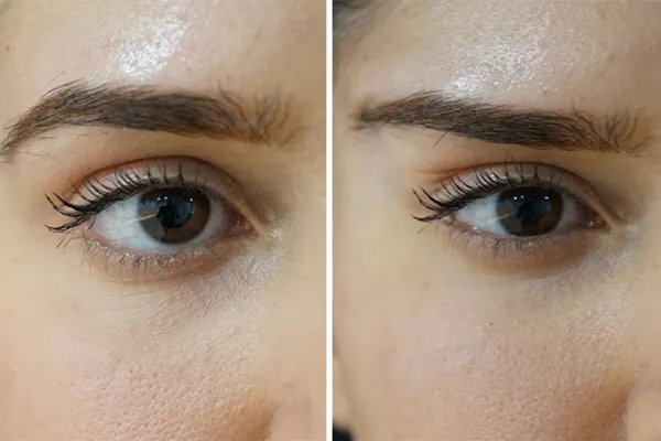 lifting de sobrancelhas ou fox eyes em Belo Horizonte