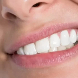 bruxismo e o tratamento com Botox