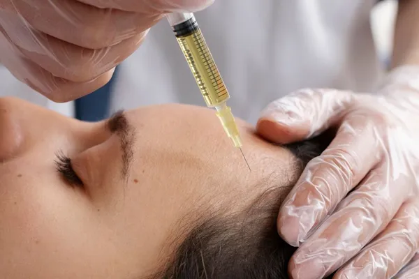 tratamento da alopécia de tração