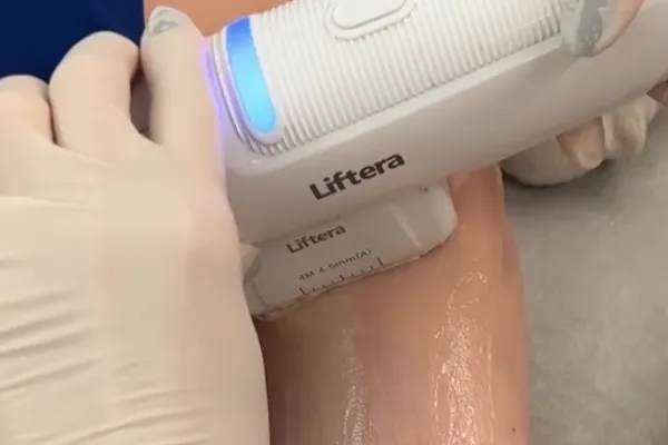 liftera para flacidez nos braços