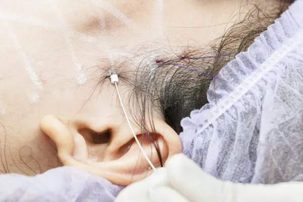 fios aptos, dra. erika freire, dermatologista em Belo Horizonte