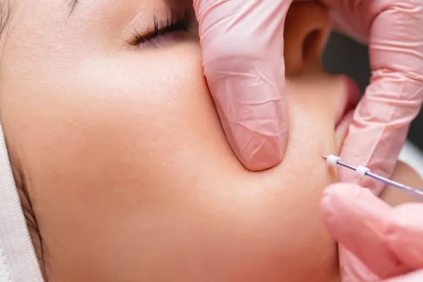 fios aptos para rejuvenescimento em bh