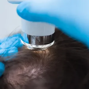 triccoscopia, exame de cabelo em Belo Horizonte