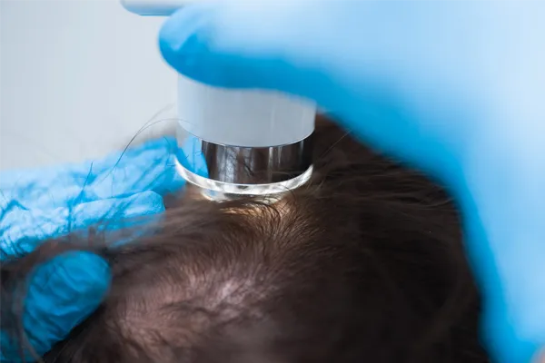triccoscopia, exame de cabelo em Belo Horizonte